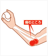なぜ肘痛が起こるのか 肘 手首のトラブル対策について トラブル対策 Sorbothane